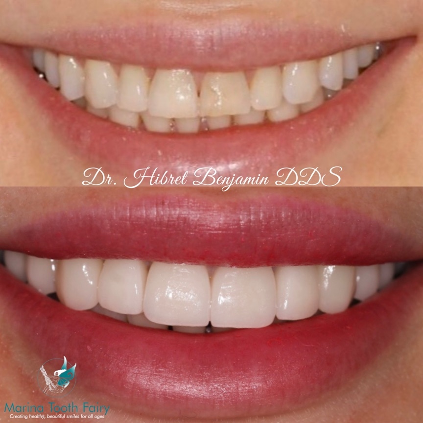 News campaign image for Marina Tooth Fairy Dental